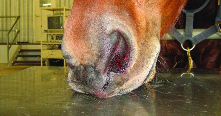 Ethmoid Haematomas