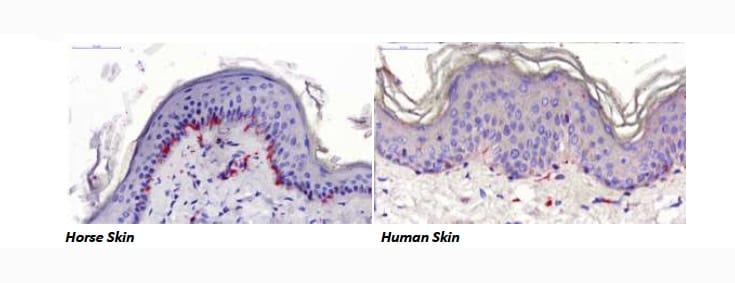 Figure 3. A special staining technique called “immunohistochemistry” allows us to specifically stain up only nerve endings, in this case they have been stained a bold red.