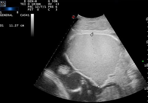 Placentitis in the mare